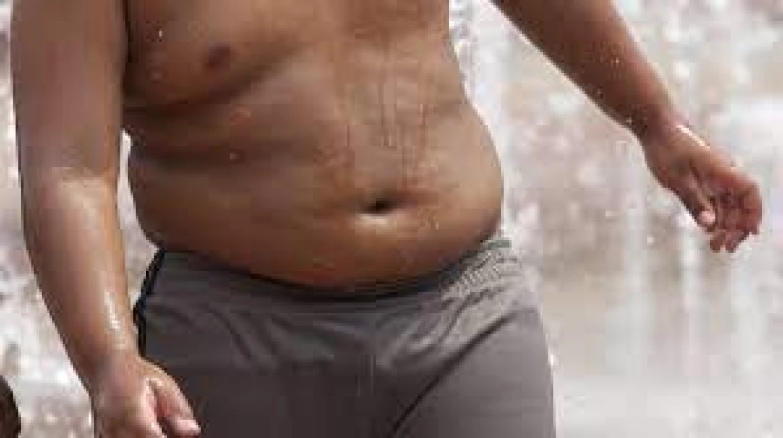 Obesity, overweight conditions could be next pandemic in Kenya-KDHS report