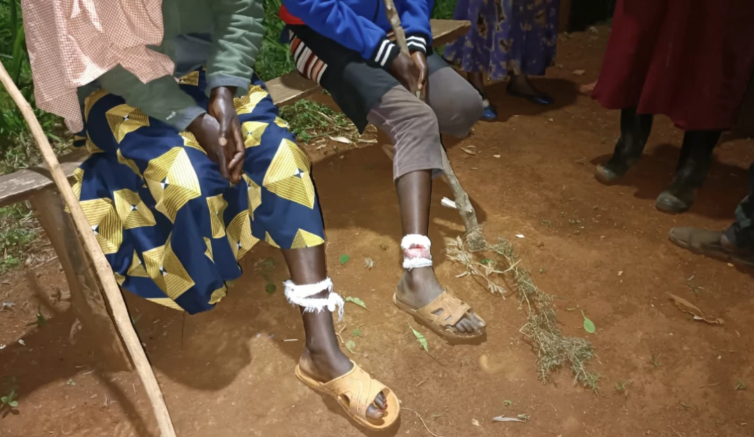 Four women attacked by hyena in Kirinyaga