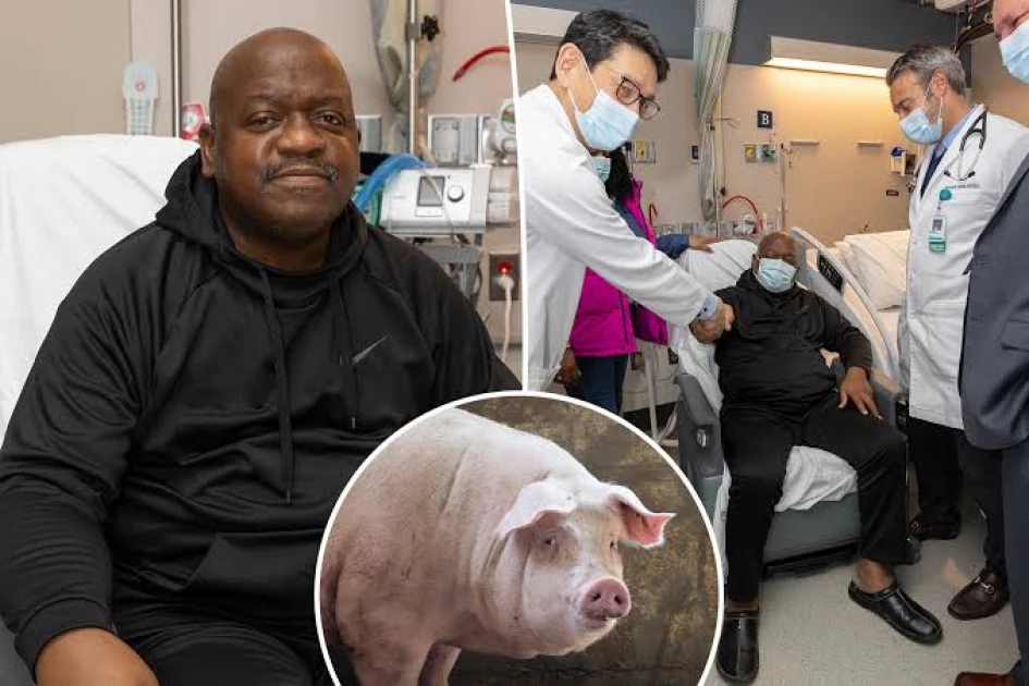 After groundbreaking surgery, the firstever pig kidney transplant