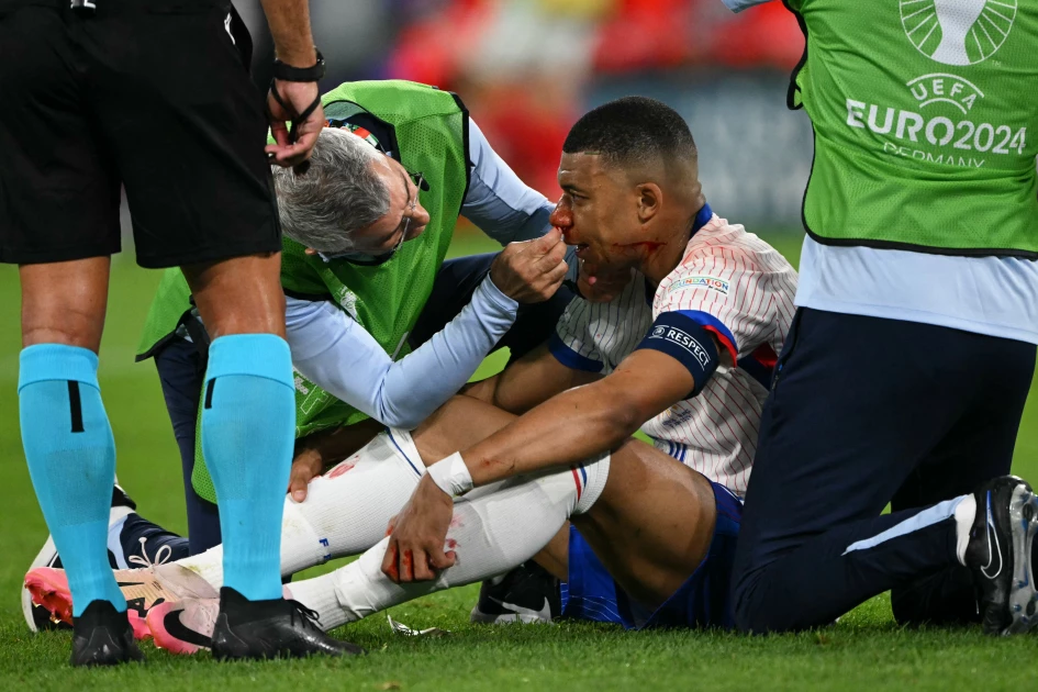France star Mbappe calls for players to get more time off France star Mbappe calls for players to get more time off