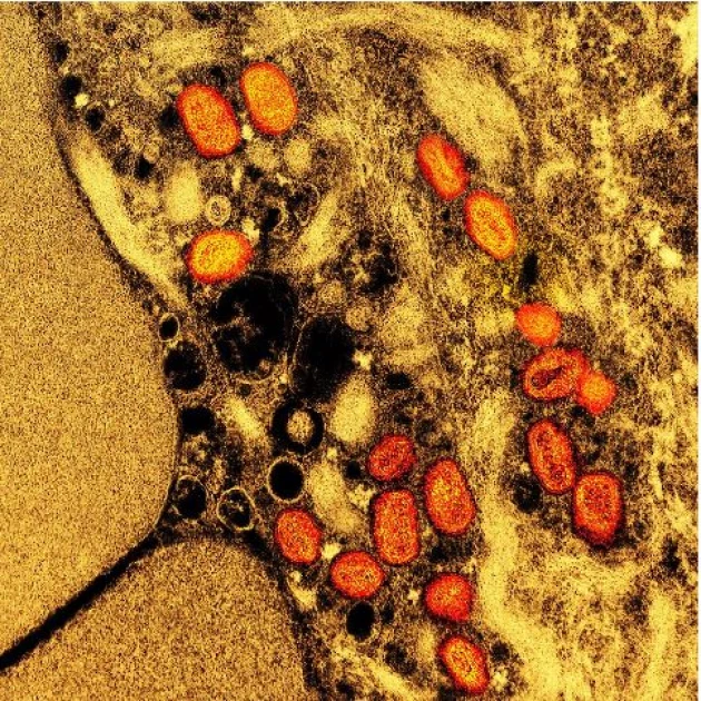 New mpox strain is changing fast; African scientists are ‘working blindly’ to respond