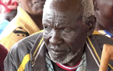 Concern over cases of cataracts among Baringo residents