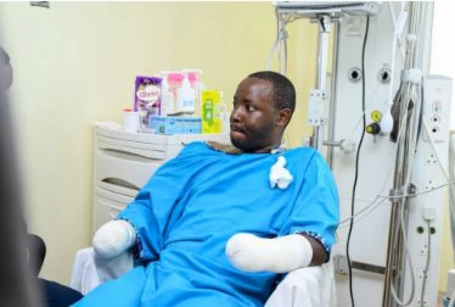 Police officer who lost hands after teargas explosion shares his recovery journey 