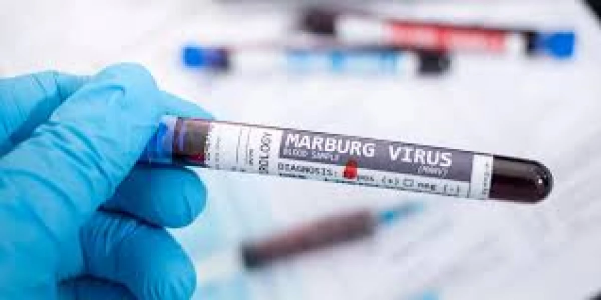 Kenya on high alert for Marburg virus amid outbreak in Rwanda