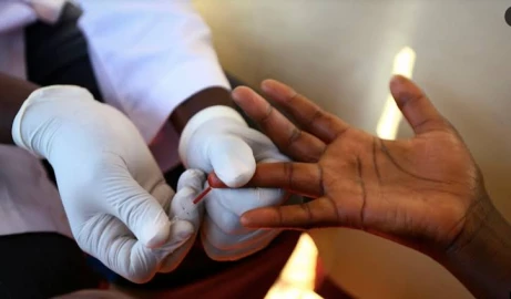 Advanced HIV in Kenya delaying fight against the AIDS epidemic 