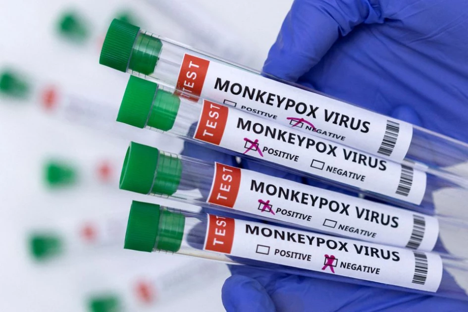 US pharmaceutical firm Tonix selects Kenya for Monkeypox vaccine trials