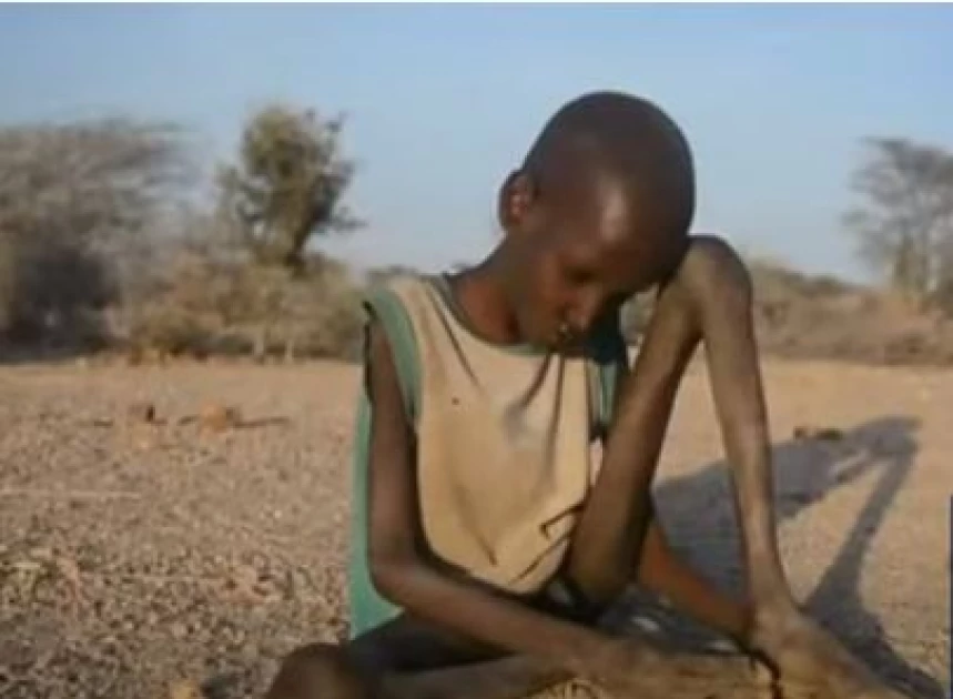 Two brothers recover from malnutrition in Turkana