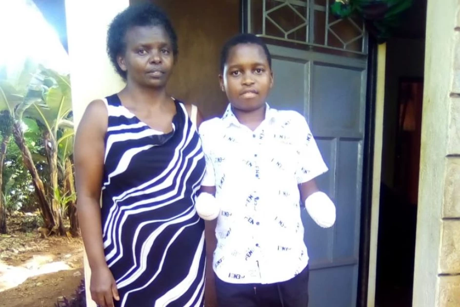 Family appeals for help to buy son prosthetic hands