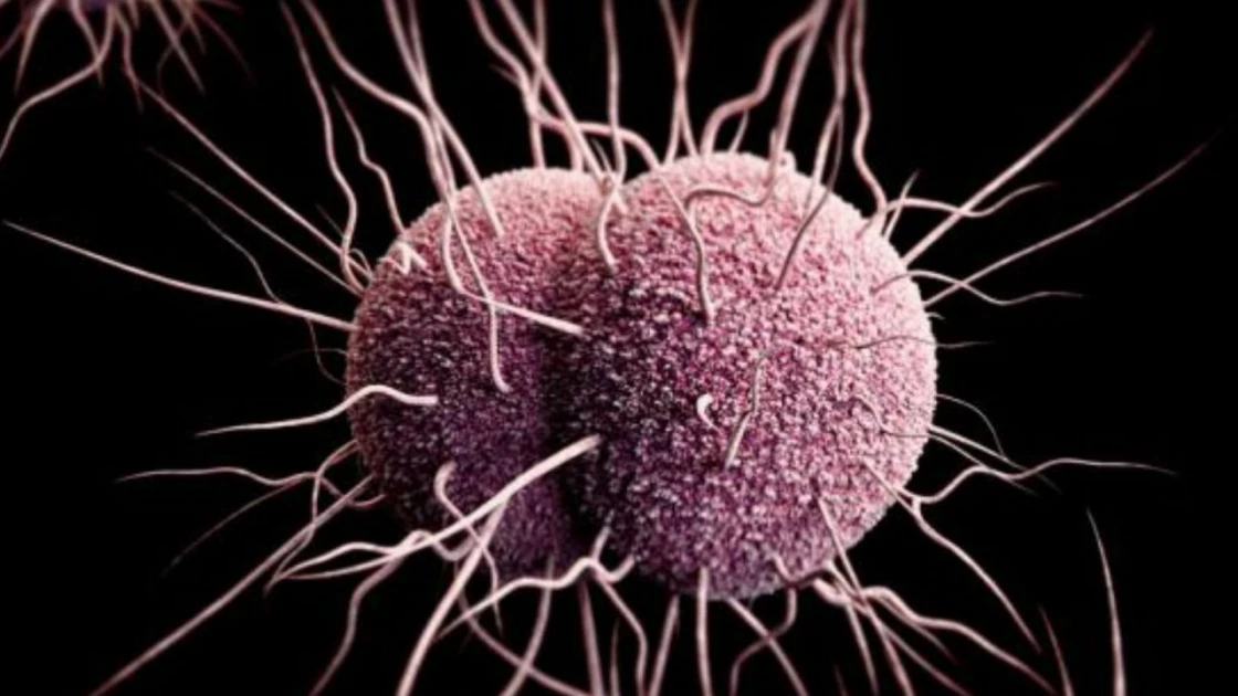 First cases of Super gonorrhea identified in the U.S.